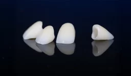 Busy Schedule? Discover How Quick Same-Day Dental Crowns Are in Winter Springs