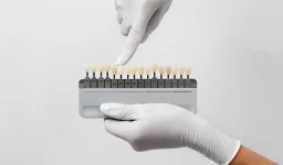 Are Dental Veneers Painful to Get? Honest Answers from Winter Springs Experts